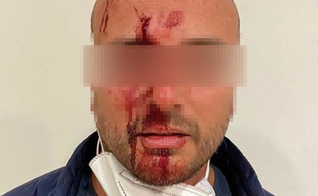 Uno de los agentes de la Policía Local de Alhaurín de la Torre, tras la agresión.