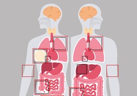 La tasa de supervivencia del cáncer alcanza el 60% en Málaga, el doble que hace 30 años