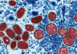 Imagen tomada con un microscopio de las partículas del virus Mpox.