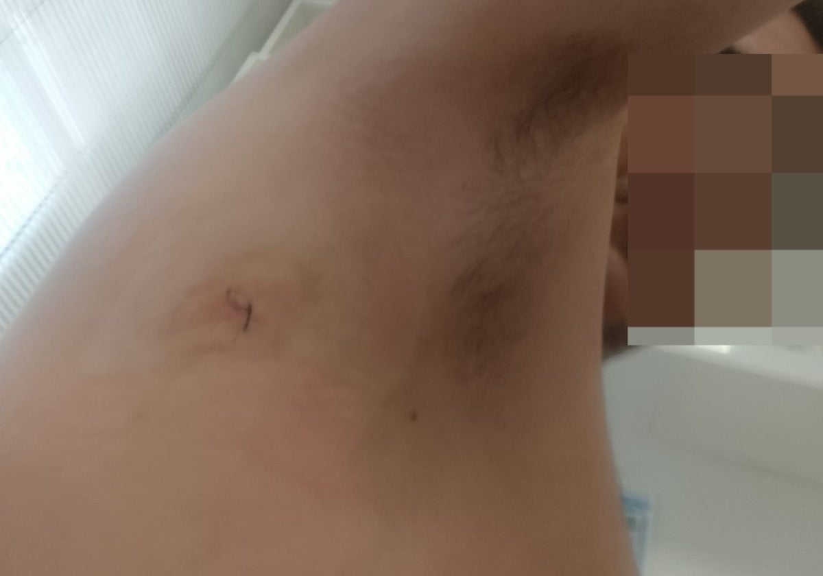 «Me pidió una pizza y me apuñaló para robarme el cambio»