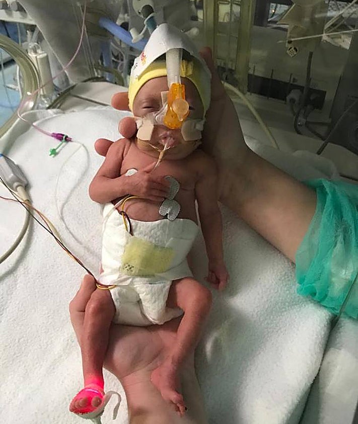 Imagen secundaria 2 - Julia, Daniela y Lucía permanecieron varios meses en la unidad de Neonatos del Materno Infantil de Málaga.