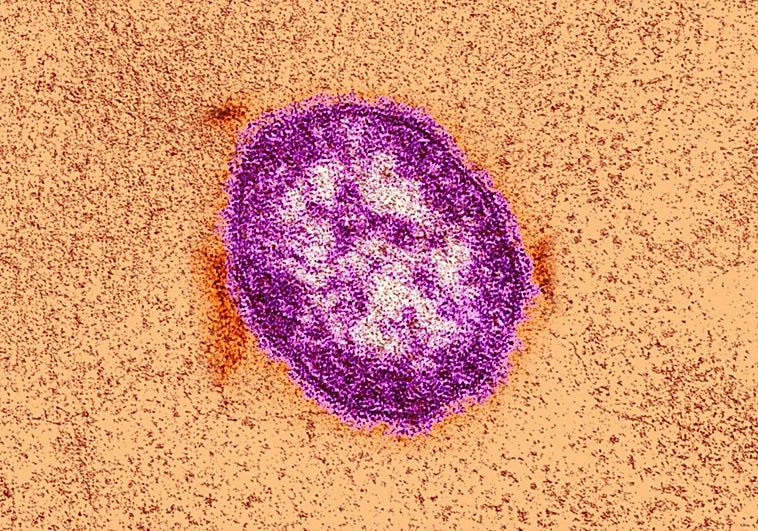 Sarampión: síntomas, cómo se transmite y situación actual en Andalucía