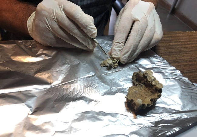 Preparación de una muestra de pieza dental de la que extraer ADN.