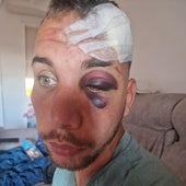 Eduardo busca la furgoneta que lo dejó grave tras tirarlo de su patinete en Benalmádena