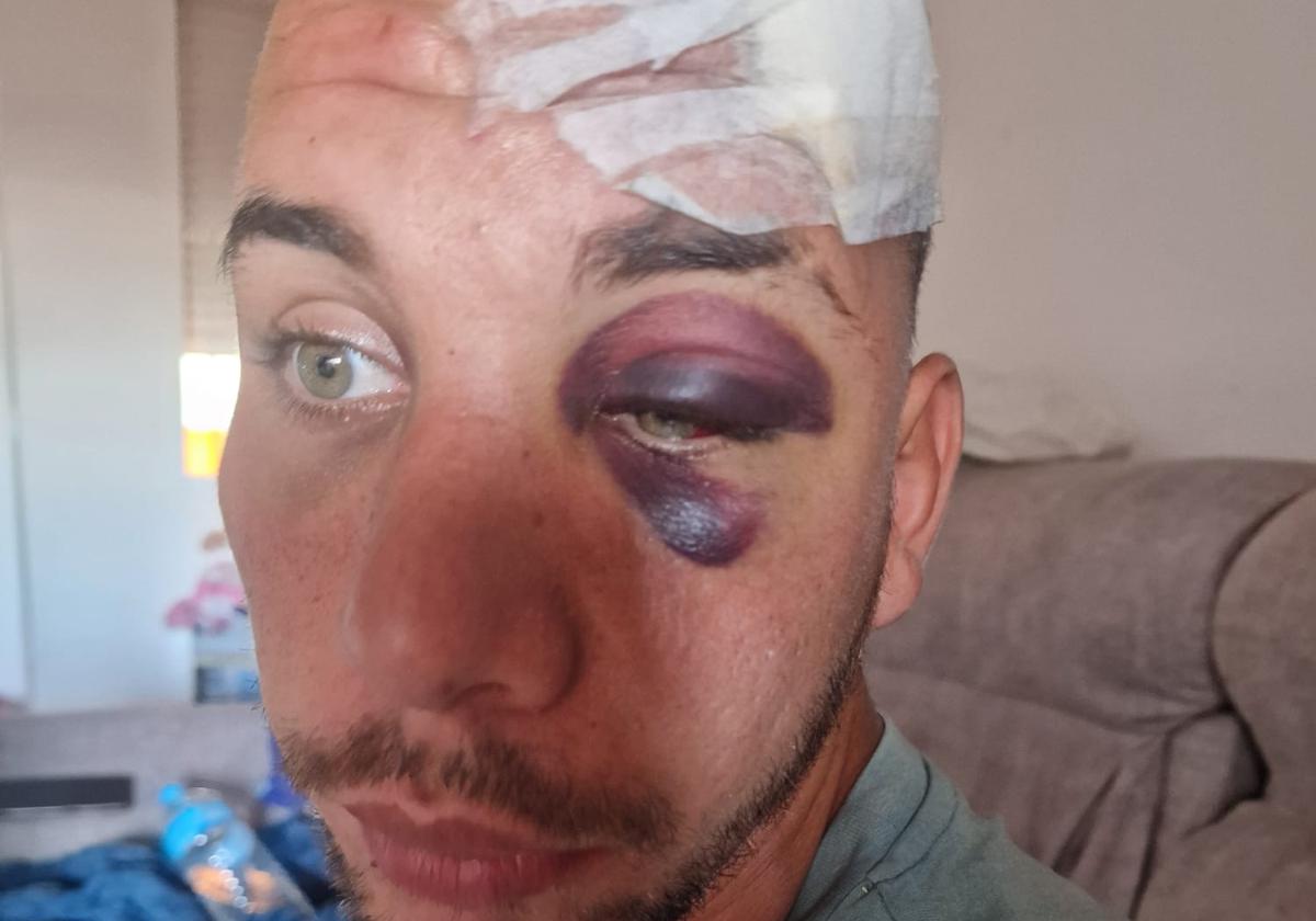 Eduardo busca la furgoneta que lo dejó grave tras tirarlo de su patinete en Benalmádena