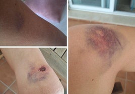 Denuncian una presunta paliza a una madre y su hija por una riña de tráfico en Benalmádena