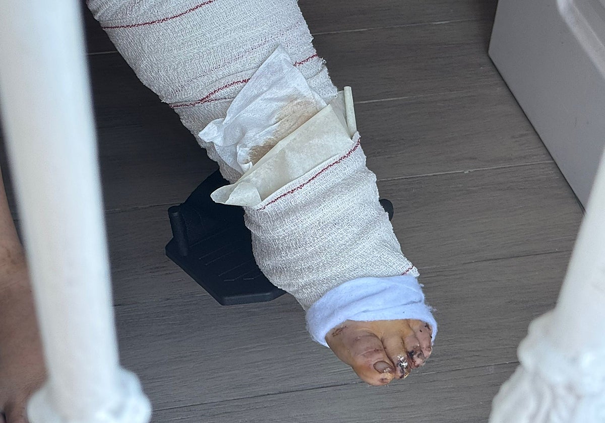 La madre de la pequeña, de 23 años, se encuentra en silla de ruedas tras haber recibido dos impactos en las piernas.