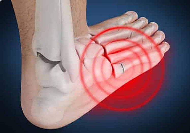 Imagen de la lesión que sufrió Castañeda.