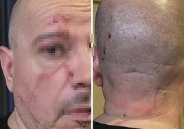 Encañonan y agreden a un vecino de Marbella de 61 años para atracarle: «¡Están matando a un hombre a golpes!»