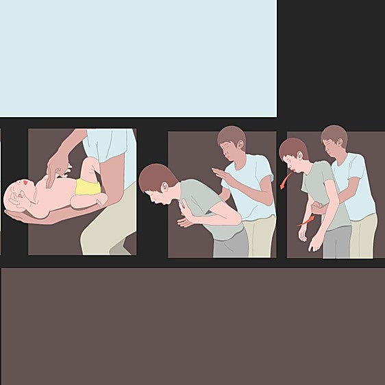 Caramelos, carne y salchichas: el 65% de los atragantamientos en niños son causados por alimentos