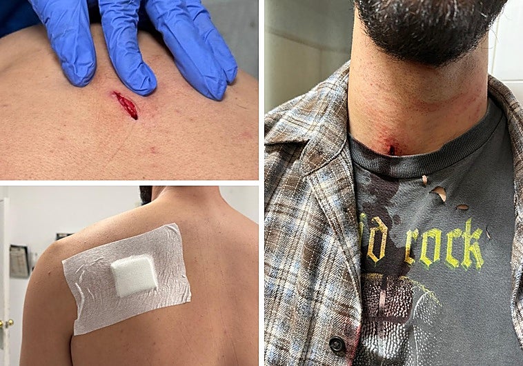 Dos encapuchados asaltan y acuchillan a un joven en plena calle en Fuengirola cuando iba a trabajar