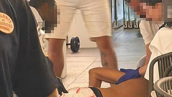 La víctima del tiroteo en Muelle Uno recibió un disparo en la cara: «Es un milagro que sobreviviera»