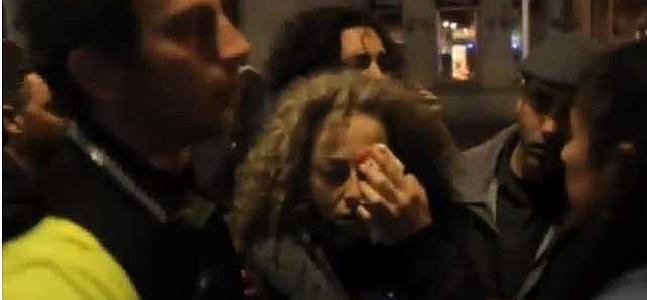 La Generalitat investiga si la mujer que perdió el ojo recibió un disparo