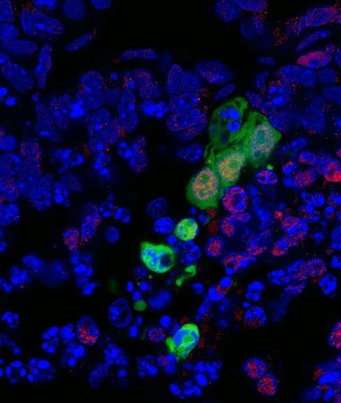 En esta imagen se muestra este nuevo tipo de célula humana en verde.