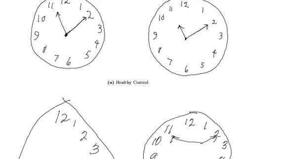 Las pruebas de dibujo del reloj realizadas por personas mayores con la  enfermedad de Alzheimer se exhiben en la estación Xujiahui en Shanghai,  China, el 9 de septiembre de 2023 Fotografía de