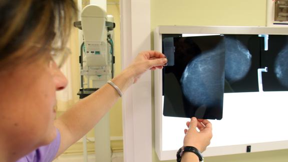 Una doctora analiza una mamografía.