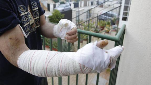 Le han dado más de 30 puntos para curar las heridas del ataque, que duró 25 minutos.