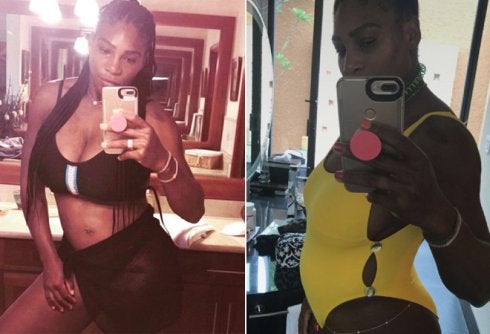 Serena Williams está embarazada