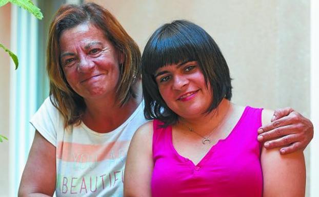 Arriba, Cristina López y su hija Eider, diagnosticada de Cornelia de Lange hace nueve años. 