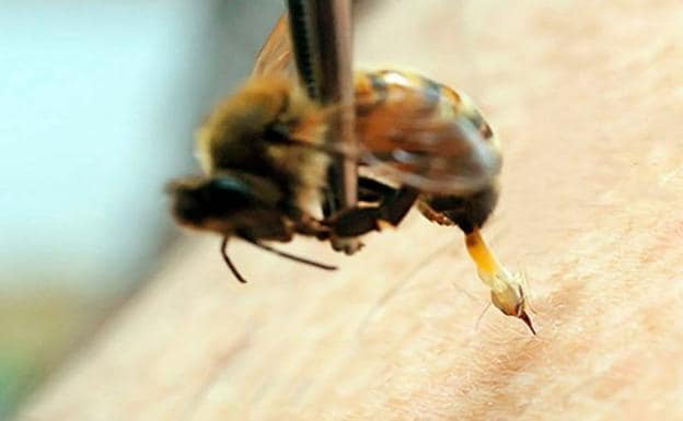 La primera muerte en el mundo por acupuntura con abejas