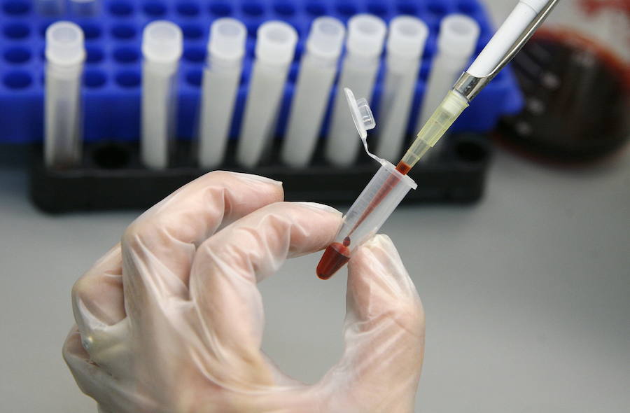Técnico de laboratorio examina muestras de sangre para descartar la presencia del virus VIH.