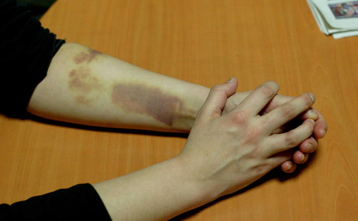 Crecen casi un 10% los delitos contra la libertad sexual en Euskadi