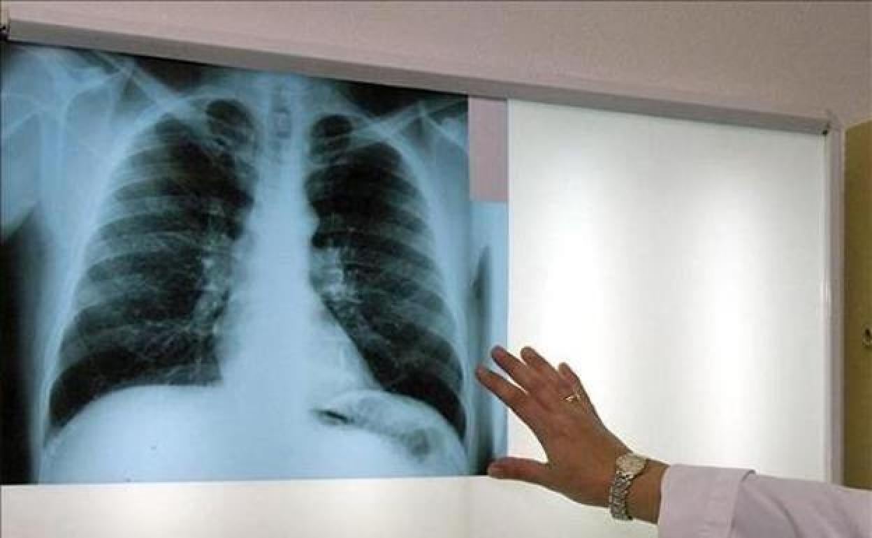 Primera sentencia favorable a una víctima del amianto por haber lavado ropa