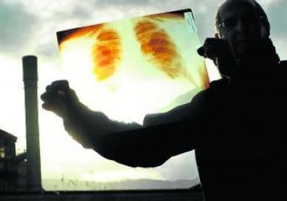 Euskadi acumula el mayor número de cánceres profesionales por amianto