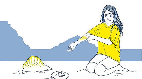«Hay que aclarar la picadura con agua de mar, no dulce»