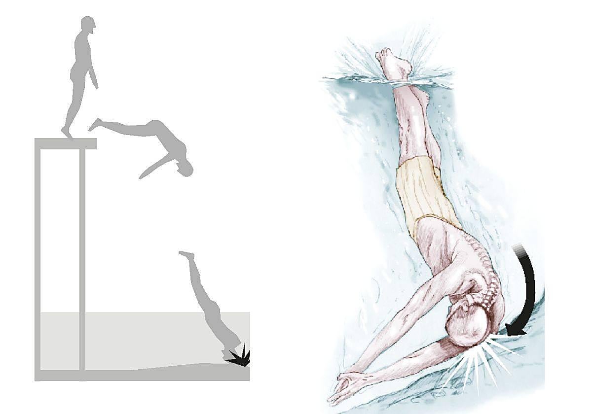 El riesgo de las zambullidas