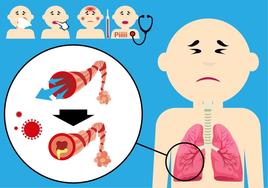 Euskadi vacunará de la bronquiolitis a bebés con riesgo y a los recién nacidos entre octubre y marzo