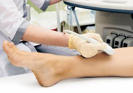 Últimas novedades contra las varices