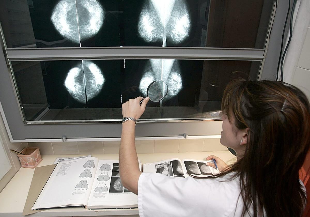 Una radióloga revisa mamografías para descartar tumores de mama.