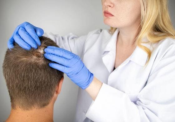 Una médico examina a un paciente con alopecia