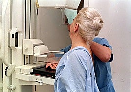 Osakidetza reconstruye la areola a 533 mujeres mastectomizadas en Gipuzkoa en cinco años