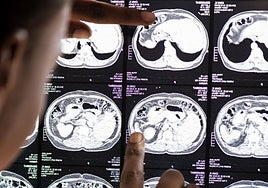 Un médico comprueba una resonancia.