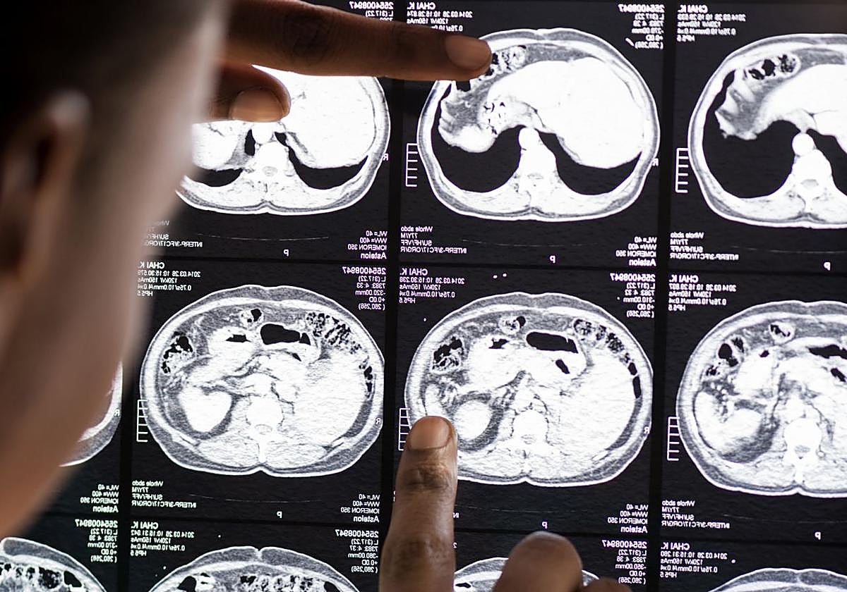 Un médico comprueba una resonancia.