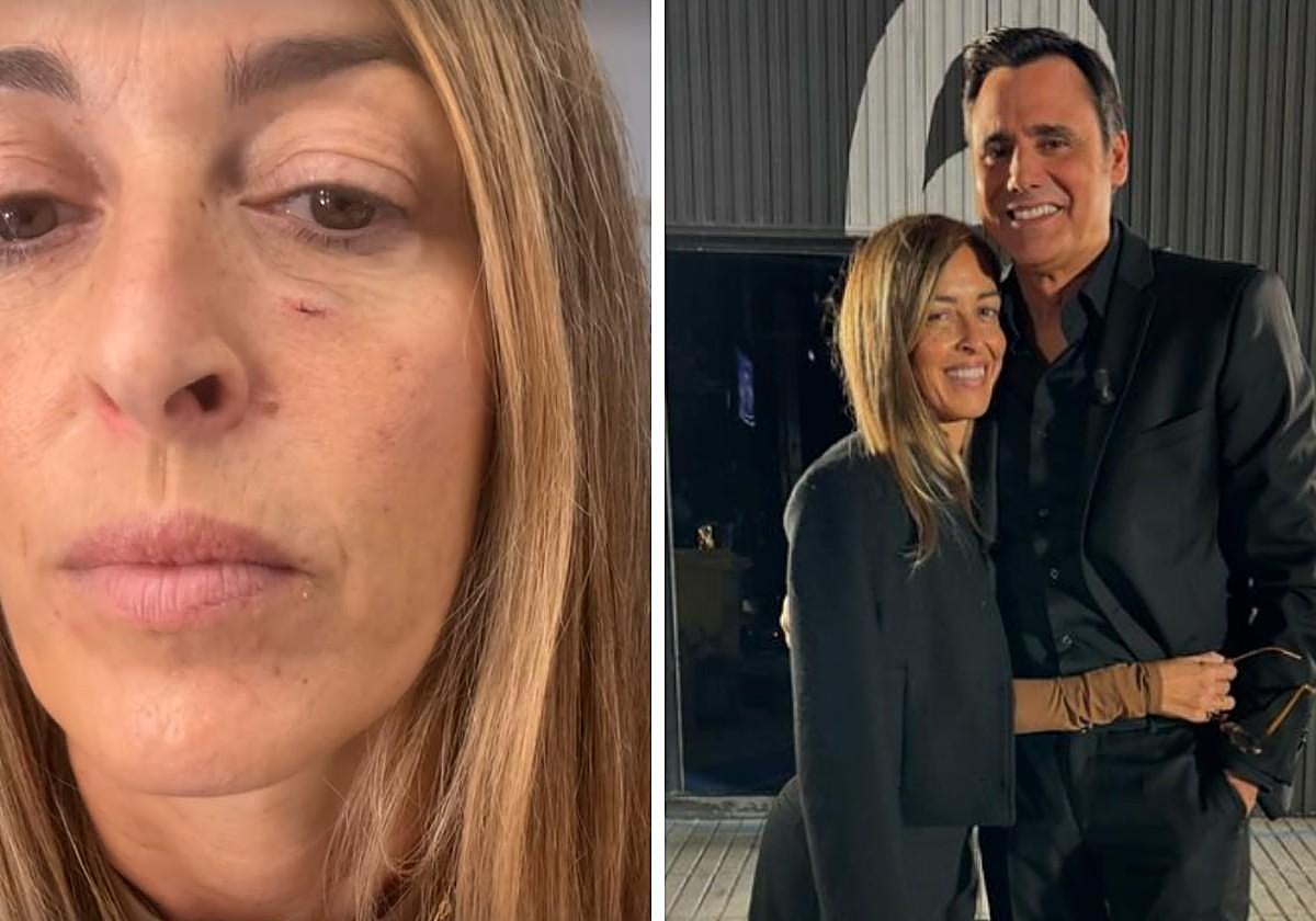 María Amores, mujer de Ion Aramendi, muestra la herida tras un percance con el aro de luz.