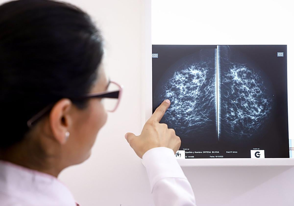 Una facultativa comprueba unas mamografías.