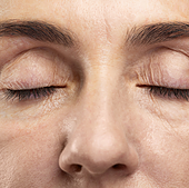 Una dermatóloga vasca explica cómo combatir las ojeras: «Lo primero es saber qué tipo tienes»