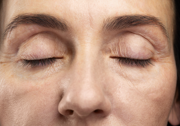 Una dermatóloga vasca explica cómo combatir las ojeras: «Lo primero es saber qué tipo tienes»
