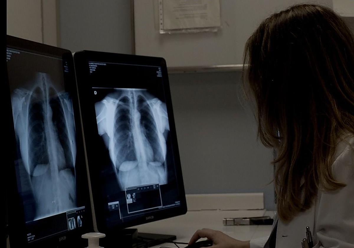 Una sanitaria inspecciona unas radiografías de un paciente.