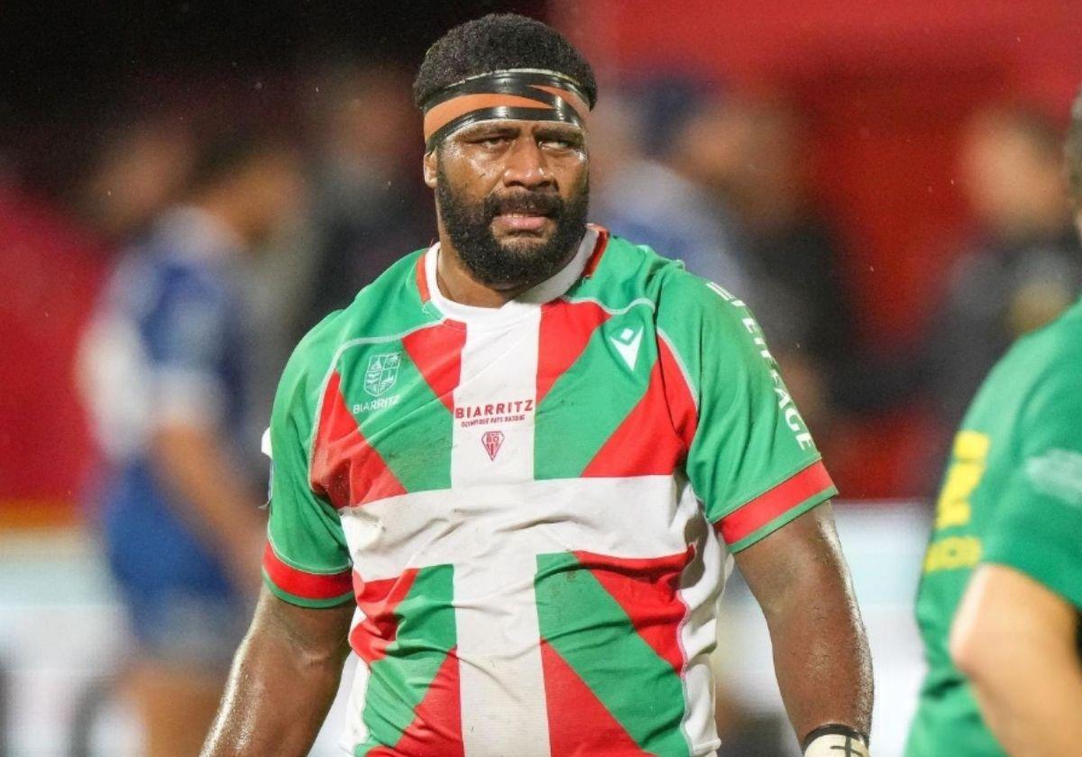 Un jugador de rugby del Biarritz podría ir a la cárcel por morder en la cara a un compañero que requirió 20 puntos de sutura