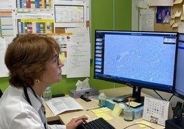 Irune Ruiz, jefa de servicio de Anatomía Patológica del Hospital Donostia, inspecciona en el ordenador una muestra.
