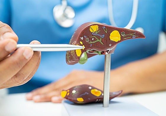 «Disponemos de nuevos fármacos que ofrecen una nueva esperanza para el tratamiento del hígado graso»