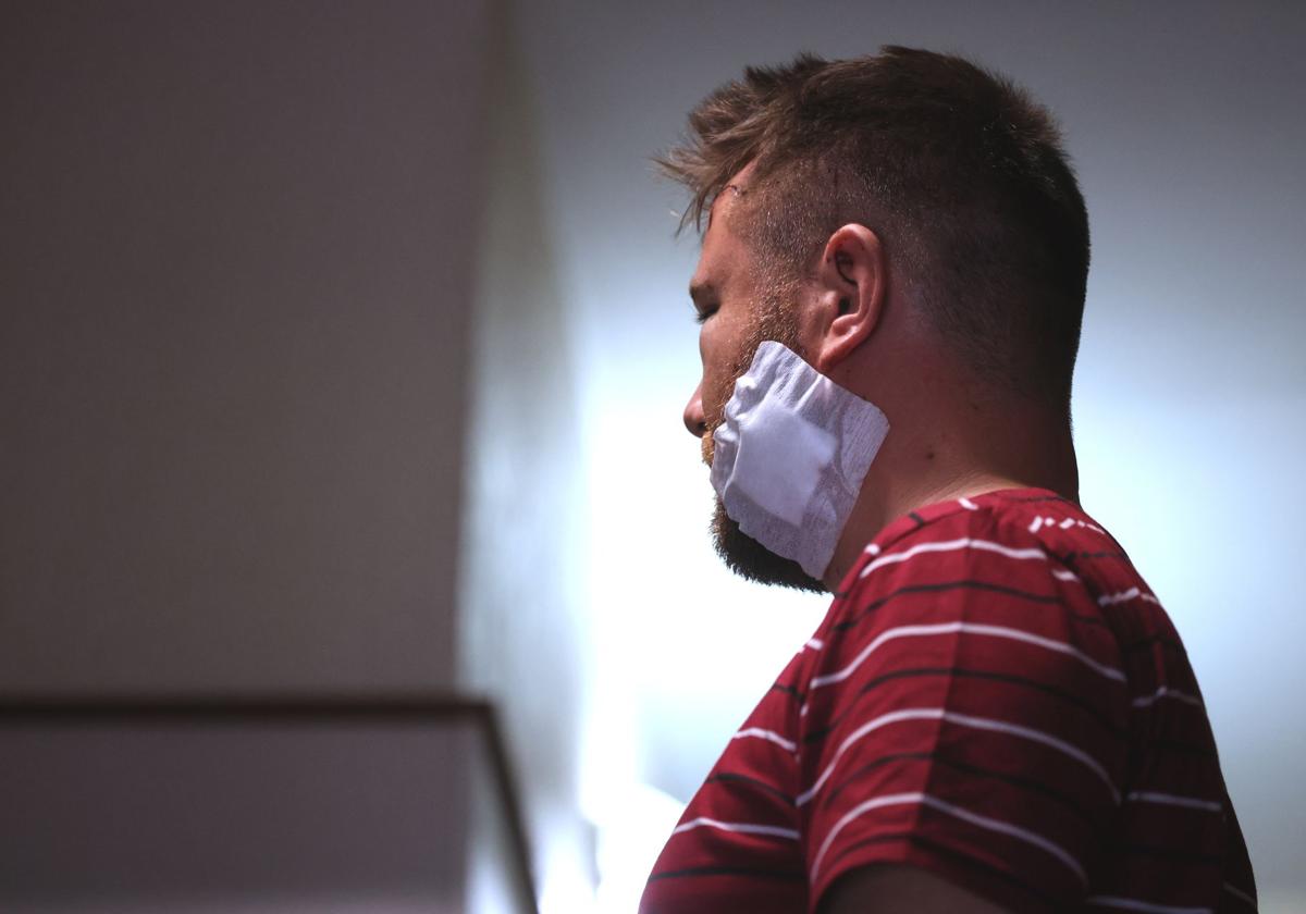 «No me han matado por muy pocos centímetros»