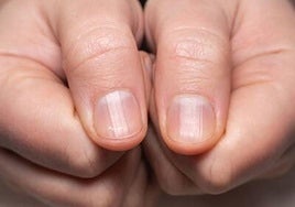Estrías en las uñas: una señal silenciosa que no se debe ignorar