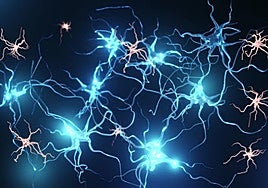 Alzhéimer: ni es genético ni solo afecta a la pérdida de memoria