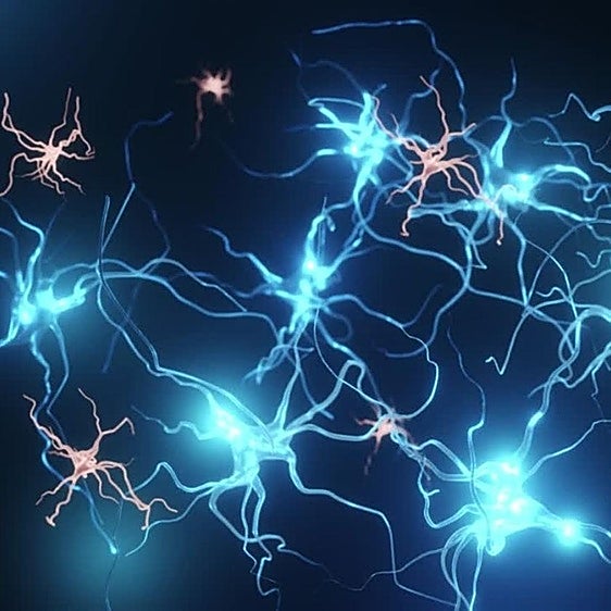 Alzhéimer: ni es genético ni solo afecta a la pérdida de memoria