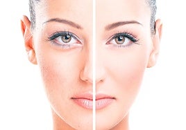 El paciente busca tratamientos no invasivos, sin tiempo de inactividad, cómodos y con resultados